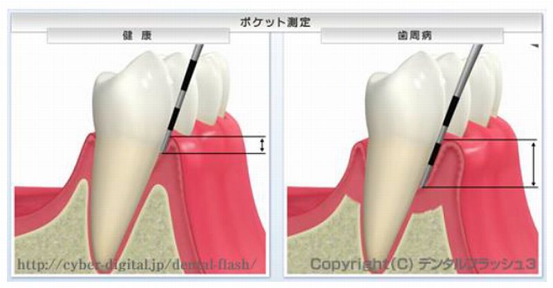 歯茎の再評価